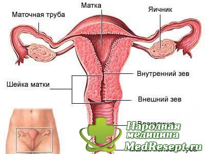 Виды кист яичников фото